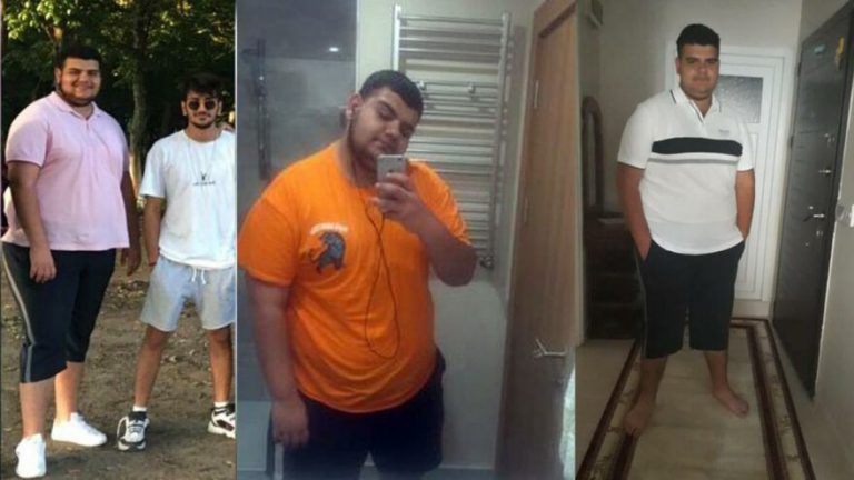Sevgilisi terk edince 6 ayda 81 kilo verdi